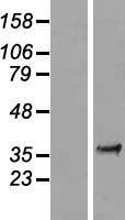 LRATD1 Human Over-expression Lysate
