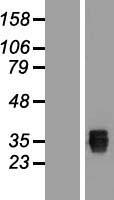 SSMEM1 Human Over-expression Lysate