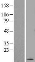 DNAJC19 Human Over-expression Lysate