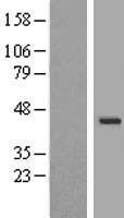 WDR31 Human Over-expression Lysate