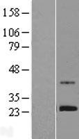 ZNF625 Human Over-expression Lysate
