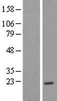 EFCAB11 Human Over-expression Lysate