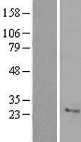 C7orf33 Human Over-expression Lysate