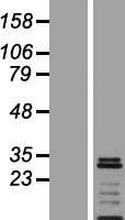 VTI1A Human Over-expression Lysate