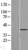 CSNK1A1L Human Over-expression Lysate