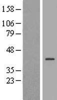 SPESP1 Human Over-expression Lysate