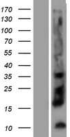 Kallikrein 12 (KLK12) Human Over-expression Lysate