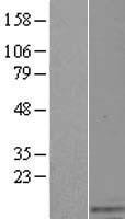 WFDC9 Human Over-expression Lysate