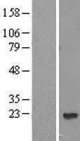 PPP3R2 Human Over-expression Lysate