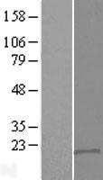 DSCR9 Human Over-expression Lysate