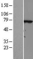 TTC30A Human Over-expression Lysate