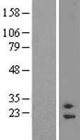 CCNQ Human Over-expression Lysate
