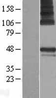 PARS2 Human Over-expression Lysate