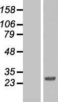 FAAP24 Human Over-expression Lysate