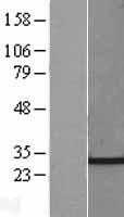 CHMP4C Human Over-expression Lysate
