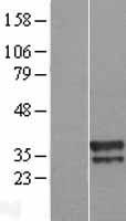 UBXD3 (UBXN10) Human Over-expression Lysate