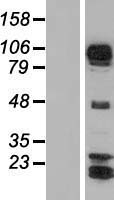 AFAP1L1 Human Over-expression Lysate