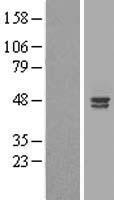 ALS2CR4 (TMEM237) Human Over-expression Lysate