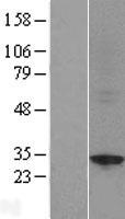 SHLD1 Human Over-expression Lysate