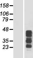 CCDC17 Human Over-expression Lysate