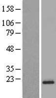 CNIH3 Human Over-expression Lysate