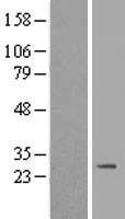 TERB2 Human Over-expression Lysate