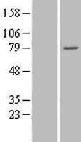TTC30B Human Over-expression Lysate