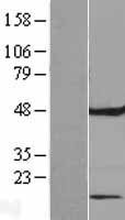 FAM86C1P Human Over-expression Lysate