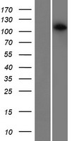 CDCA2 Human Over-expression Lysate