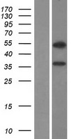 CBLL2 Human Over-expression Lysate