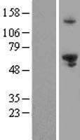 EXDL1 (EXD1) Human Over-expression Lysate