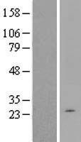 DYNLT5 Human Over-expression Lysate