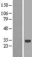 THAP8 Human Over-expression Lysate