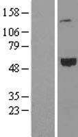 CCER1 Human Over-expression Lysate