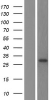 METTL7B Human Over-expression Lysate