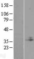 C1GALT1C1 Human Over-expression Lysate