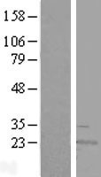 RWDD4A (RWDD4) Human Over-expression Lysate