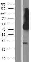 HEPACAM Human Over-expression Lysate