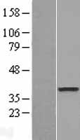 DOK6 Human Over-expression Lysate