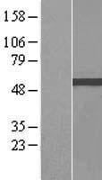 ZBTB9 Human Over-expression Lysate