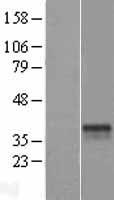 ST6GALNAC3 Human Over-expression Lysate