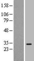 OFCC1 Human Over-expression Lysate