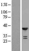 Tbp7 (PSMC4) Human Over-expression Lysate