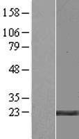 CCDC140 Human Over-expression Lysate
