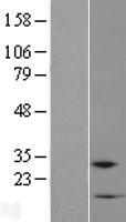 RPP38-DT Human Over-expression Lysate