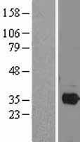 PITX2 Human Over-expression Lysate