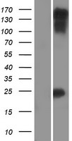 Myocardin (MYOCD) Human Over-expression Lysate