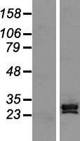 SCP3 (SYCP3) Human Over-expression Lysate