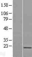 SKP1 Human Over-expression Lysate