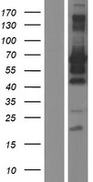MEIS2 Human Over-expression Lysate